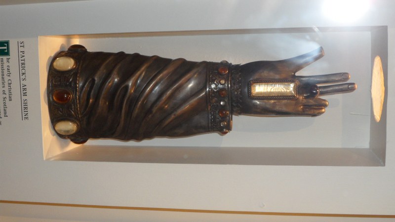 Arm